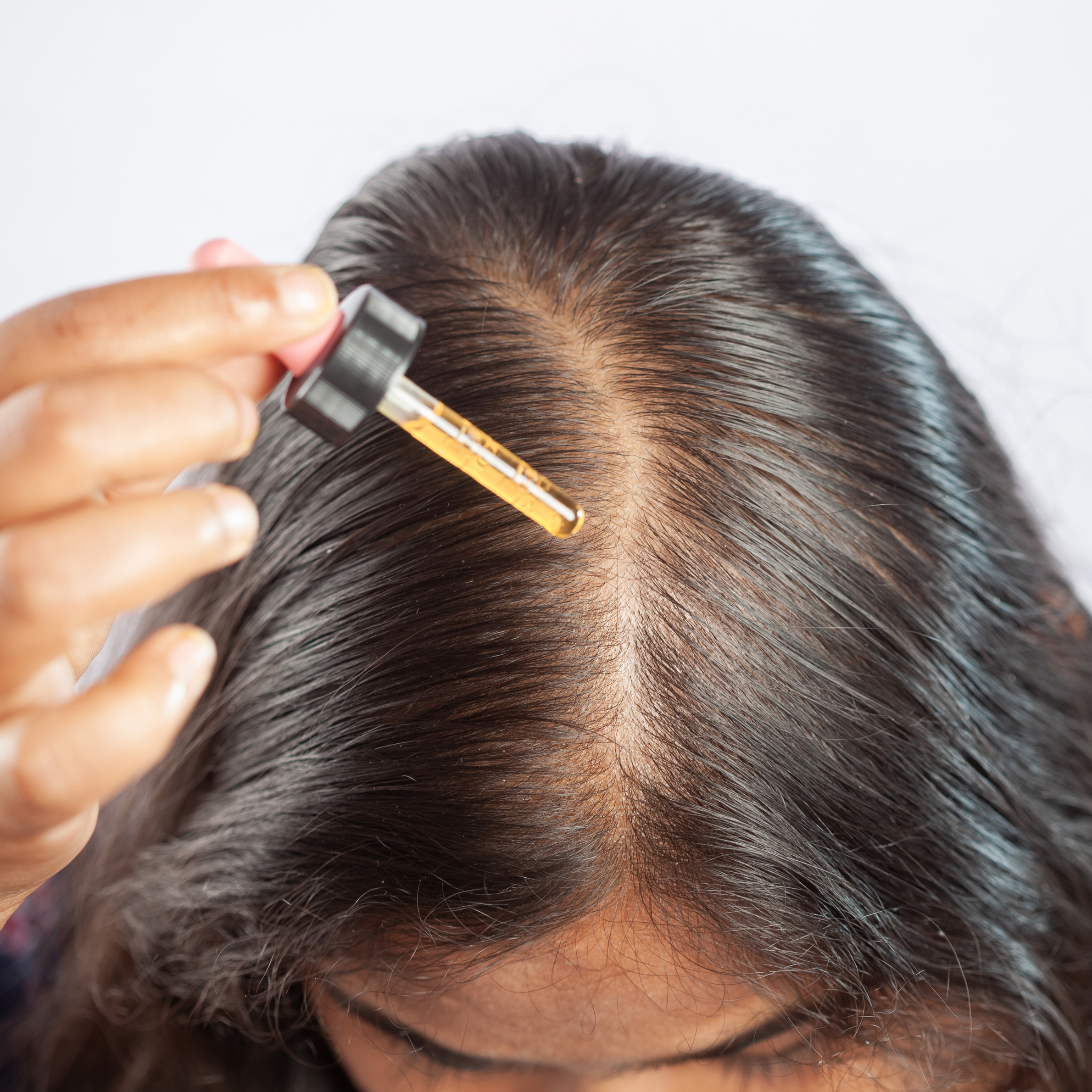 The Architecture of Hair Restoration: Deep-Tissue Scalp Therapy and Follicular Dynamics