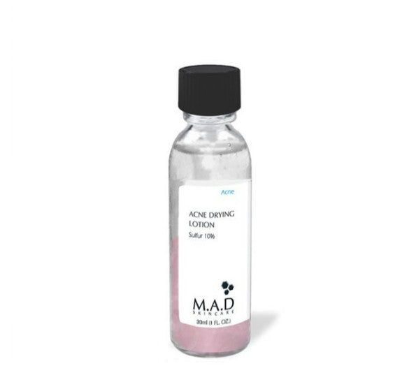 M.A.D Acne Drying Lotion w/ Sulfur 10% – Overnight Spot Treatment, 1 oz