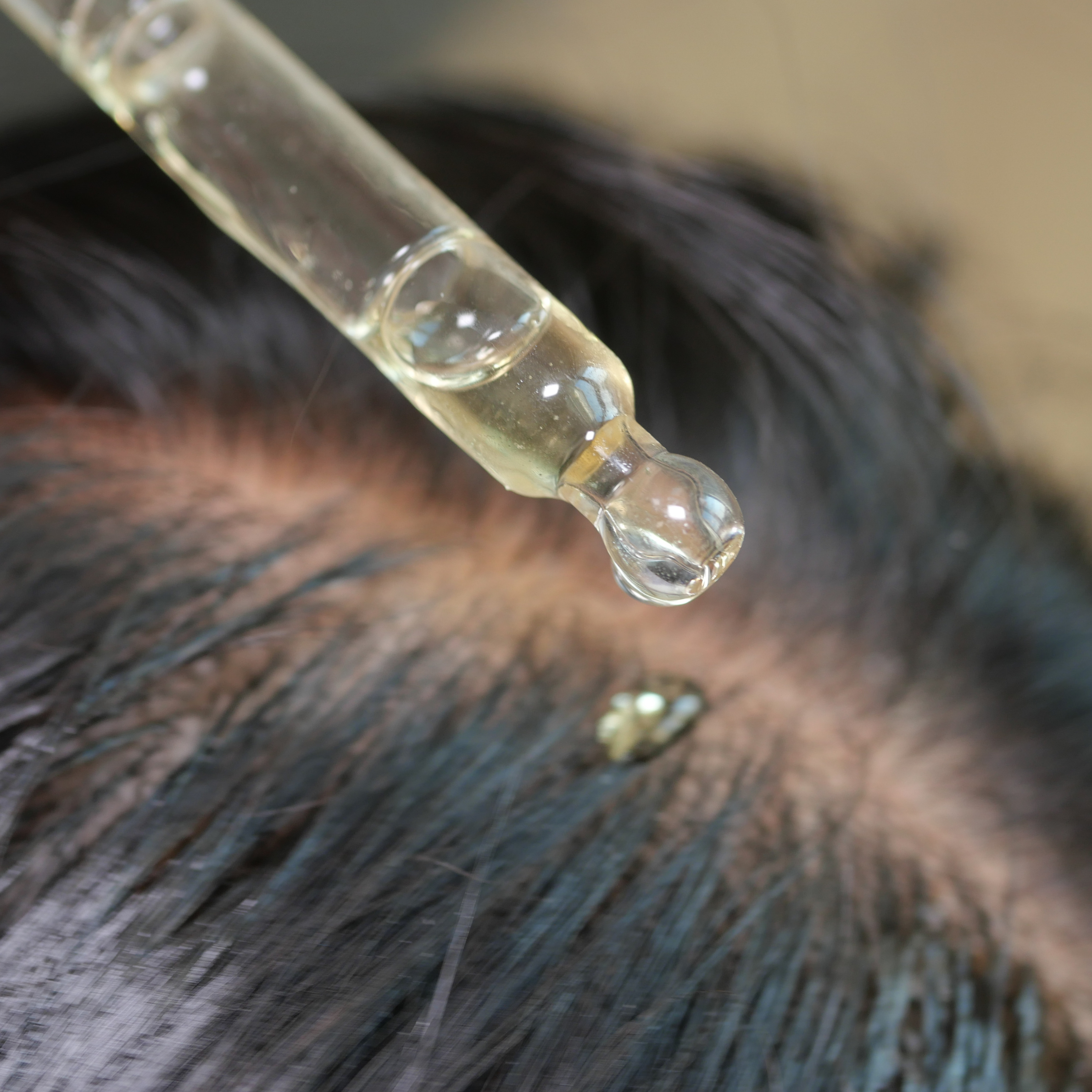 The Biology of Follicular Rejuvenation: A Clinical Approach to Scalp Health and Hair Density
